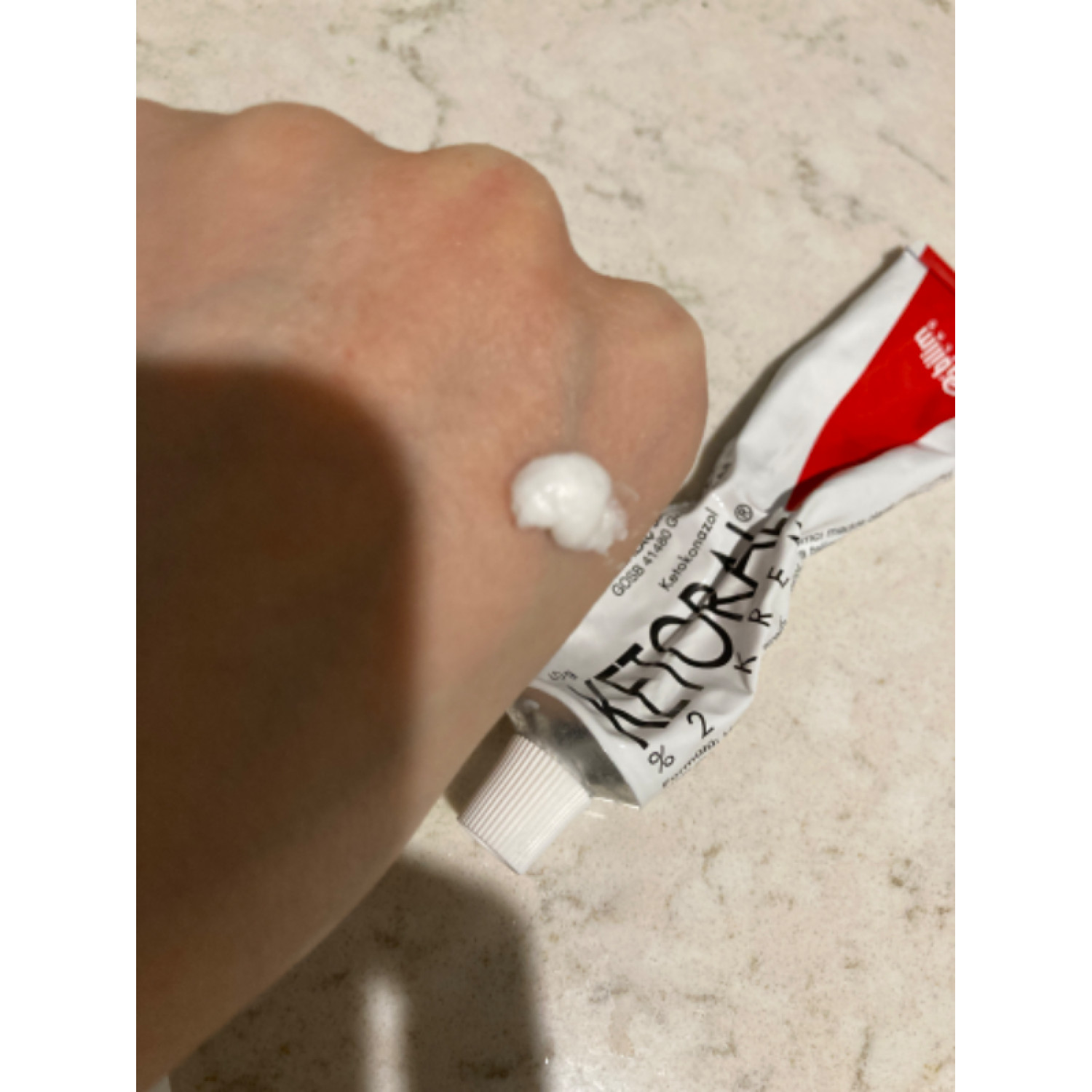 ケトコナゾールクリーム2 ケトラル 通販 水虫 カンジダ 薬通販ベストケンコー